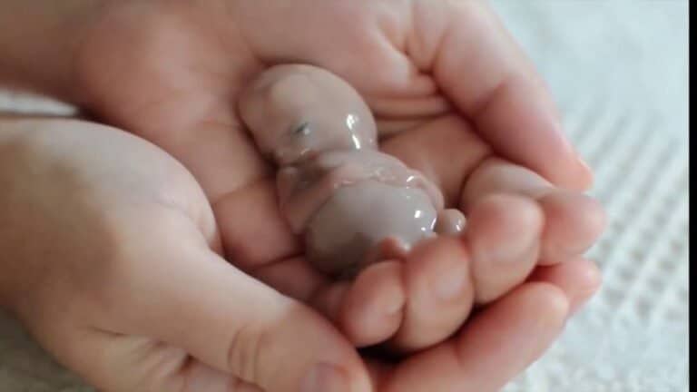 V 13. tednu nosečnosti je doživela spontani splav in posnela fotografije svojega “otroka”!